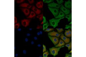 ABIN6263603 and ABIN6278495 staining Hela cells by IF/ICC. (Netrin 1 Antikörper  (C-Term))