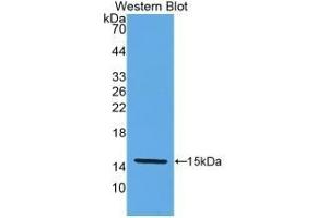 Detection of Recombinant KLb, Human using Monoclonal Antibody to Klotho Beta (KLb) (Klotho beta Antikörper  (AA 517-636))
