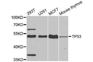 Western blot analysis of extracts of various cell lines, using TP53 antibody. (p53 Antikörper  (C-Term))