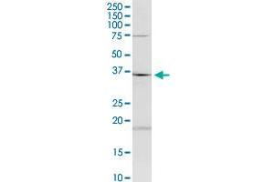 HAGHL monoclonal antibody (M01), clone 5B12. (HAGHL Antikörper  (AA 183-282))