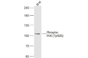 B16 lysates probed with Phospho-FAK (Tyr925) Polyclonal Antibody, Unconjugated  at 1:300 dilution and 4˚C overnight incubation. (FAK Antikörper  (pTyr925))