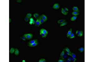 Immunofluorescent analysis of HepG2 cells using ABIN7165052 at dilution of 1:100 and Alexa Fluor 488-congugated AffiniPure Goat Anti-Rabbit IgG(H+L) (ZBTB8OS Antikörper  (AA 2-136))
