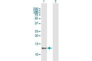 Western Blot analysis of SNRNP25 expression in transfected 293T cell line by SNRNP25 MaxPab polyclonal antibody.