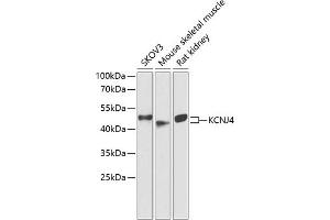 Western blot analysis of extracts of various cell lines, using KCNJ4 antibody (ABIN6134096, ABIN6142734, ABIN6142737 and ABIN6218214) at 1:1000 dilution. (KCNJ4 Antikörper  (AA 50-150))