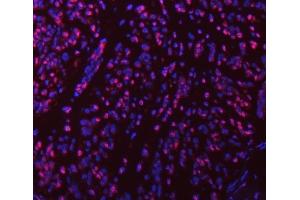 IF analysis of SART1 using anti-SART1 antibody (ABIN7599884). (SART1 Antikörper  (AA 125-800))