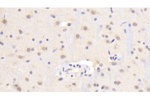 Detection of TREM2 in Rat Cerebrum Tissue using Polyclonal Antibody to Triggering Receptor Expressed On Myeloid Cells 2 (TREM2)