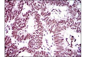Immunohistochemistry (IHC) image for anti-Ring Finger Protein 1 (RING1) (AA 79-263) antibody (ABIN1845880) (RING1 Antikörper  (AA 79-263))