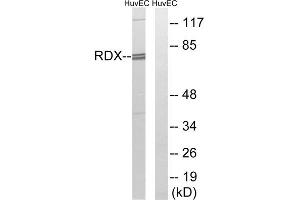Western blot analysis of extracts from HuvEc cells, using RDX antibody. (Radixin Antikörper  (Internal Region))