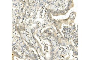 IHC analysis of BubR1/BUB1B using anti-BubR1/BUB1B antibody (ABIN7600960). (BUB1B Antikörper  (AA 26-448))