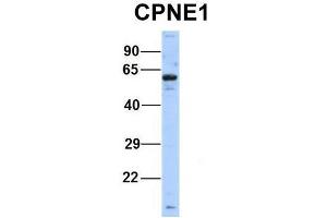 Host:  Rabbit  Target Name:  CPNE1  Sample Type:  Human Hela  Antibody Dilution:  1. (CPNE1 Antikörper  (Middle Region))