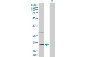 Western Blotting (WB) image for anti-TAF8 RNA Polymerase II, TATA Box Binding Protein (TBP)-Associated Factor, 43kDa (TAF8) (AA 1-174) antibody (ABIN530621)