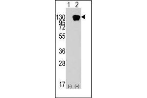 Image no. 1 for anti-Receptor Tyrosine Kinase-Like Orphan Receptor 1 (ROR1) (AA 112-399) antibody (ABIN359929) (ROR1 Antikörper  (AA 112-399))