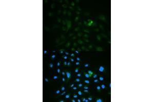 Immunofluorescence analysis of MCF7 cell using CD79B antibody. (CD79b Antikörper  (AA 29-159))