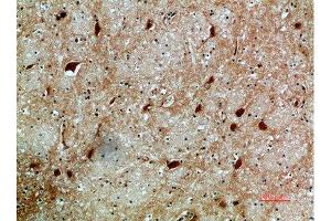 Immunohistochemistry (IHC) image for anti-Nuclear Factor of Activated T-Cells 5, Tonicity-Responsive (NFAT5) (AA 1268-1341) antibody (ABIN7189436)