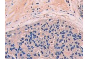 Used in DAB staining on fromalin fixed paraffin- embedded kidney tissue (Complement Factor B Antikörper  (AA 35-160))