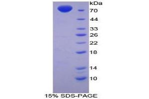 SDS-PAGE analysis of Chicken MSE Protein. (MSE Protein)