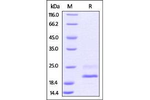 Biotinylated Mouse TNF-alpha Protein, His Tag on SDS-PAGE under reducing (R) condition. (TNF alpha Protein (AA 80-235) (His tag,AVI tag,Biotin))