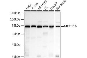 Western blot analysis of extracts of various cell lines, using METTL16 antibody (ABIN7268501) at 1:1000 dilution. (METTL16 Antikörper  (AA 263-562))