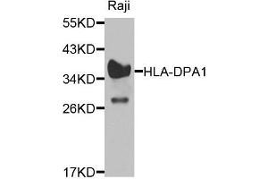 Western blot analysis of extracts of raji cells, using HLA-DPA1 antibody. (HLA-DPA1 Antikörper)