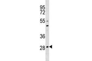 OSCAR antibody western blot analysis in 293 lysate.