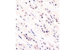 Antibody staining CDC73 in human adrenal gland tissue sections by Immunohistochemistry (IHC-P - paraformaldehyde-fixed, paraffin-embedded sections). (HRPT2 Antikörper  (AA 132-161))