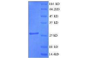SDS-PAGE (SDS) image for Myosin Binding Protein C, Cardiac (MYBPC3) (AA 645-864), (partial) protein (His tag) (ABIN5713684)