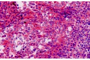 Human Tonsil: Formalin-Fixed, Paraffin-Embedded (FFPE) (SQSTM1 Antikörper  (AA 383-409))