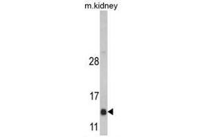 Image no. 1 for anti-DnaJ (Hsp40) Homolog, Subfamily C, Member 19 (DNAJC19) (Middle Region) antibody (ABIN452917)