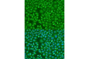 Immunofluorescence analysis of U2OS cells using LLGL2 antibody (ABIN6131794, ABIN6143262, ABIN6143265 and ABIN6224298) at dilution of 1:100. (LLGL2 Antikörper  (AA 620-819))