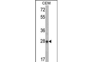 Western blot analysis of IGFBP6 Antibody (C-term) (ABIN390729 and ABIN2841001) in CEM cell line lysates (35 μg/lane). (IGFBP6 Antikörper  (C-Term))