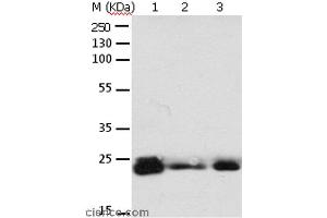 Western blot analysis of 293T cell and mouse brain tissue, A549, Hela, A172 and HT-29 cell, using RAB6A Polyclonal Antibody at dilution of 1:650 (RAB6A Antikörper)
