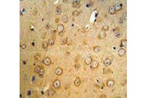 VHL antibody IHC analysis in formalin fixed and paraffin embedded mouse brain tissue. (VHL Antikörper  (AA 181-210))