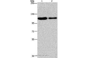 Western blot analysis of Hela and A172 cell, using PDE4A Polyclonal Antibody at dilution of 1:300 (PDE4A Antikörper)