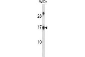 Western blot analysis in WiDr cell line lysates (35ug/lane) using NDP kinase A Antibody . (NME1 Antikörper  (Middle Region))