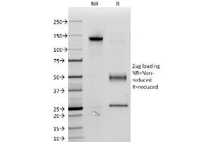SDS-PAGE Analysis Purified CD34 Monoclonal Antibody (ICO-115). (CD34 Antikörper)