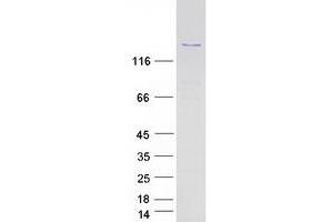 Western Blotting (WB) image for Protein Phosphatase 1, Regulatory Subunit 13B (PPP1R13B) protein (Myc-DYKDDDDK Tag) (ABIN2729471)