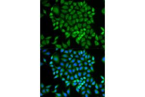 Immunofluorescence analysis of MCF-7 cells using GLRX antibody. (Glutaredoxin 1 Antikörper)