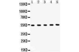 Anti- MMP3 Picoband antibody, Western blotting All lanes: Anti MMP3  at 0. (MMP3 Antikörper  (C-Term))