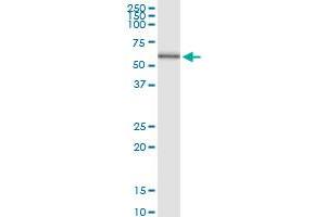 Immunoprecipitation of PPAT transfected lysate using anti-PPAT MaxPab rabbit polyclonal antibody and Protein A Magnetic Bead , and immunoblotted with PPAT purified MaxPab mouse polyclonal antibody (B01P) . (PPAT Antikörper  (AA 1-517))