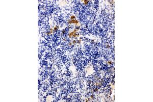 Anti-Leupaxin antibody, IHC(P) IHC(P): Rat Spleen Tissue (Leupaxin Antikörper  (N-Term))