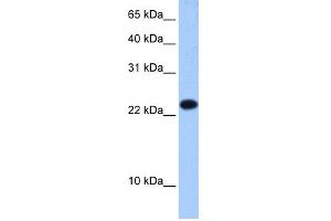 WB Suggested Anti-EIF4E3 Antibody Titration:  0.
