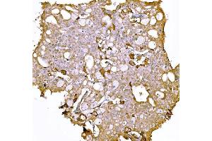 IHC analysis of Prothrombin using anti-Prothrombin antibody (ABIN7602705). (Prothrombin Fragment 2 (AA 97-124) Antikörper)