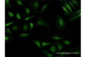 Immunofluorescence of purified MaxPab antibody to BAHD1 on HeLa cell. (BAHD1 Antikörper  (AA 1-780))