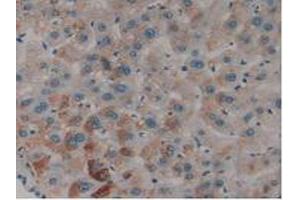 IHC-P analysis of Human Liver Tissue, with DAB staining. (PLAT Antikörper  (AA 36-126))