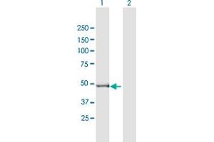 Western Blot analysis of GPT2 expression in transfected 293T cell line by GPT2 MaxPab polyclonal antibody. (GPT2 Antikörper  (AA 1-523))