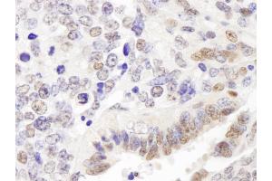 Immunohistochemistry (IHC) image for anti-GATA Zinc Finger Domain Containing 2A (GATAD2A) (AA 573-633) antibody (ABIN7448708) (GATAD2A Antikörper  (AA 573-633))
