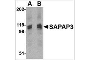 Western blot analysis of SAPAP3 in rat brain tissue lysate with this product at (A) 1 (B) 2 μg/ml. (DLGAP3 Antikörper  (C-Term))