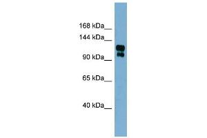 TRPA1 antibody used at 1 ug/ml to detect target protein. (TRPA1 Antikörper  (Middle Region))