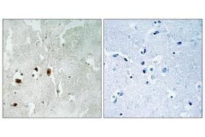 Immunohistochemistry analysis of paraffin-embedded human brain tissue using Tip60 (Phospho-Ser90) antibody. (KAT5 Antikörper  (pSer90))