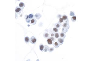 Immunocytochemistry (ICC) image for anti-Hypoxia Inducible Factor 1, alpha Subunit (Basic Helix-Loop-Helix Transcription Factor) (HIF1A) (AA 433-826) antibody (ABIN7453994)